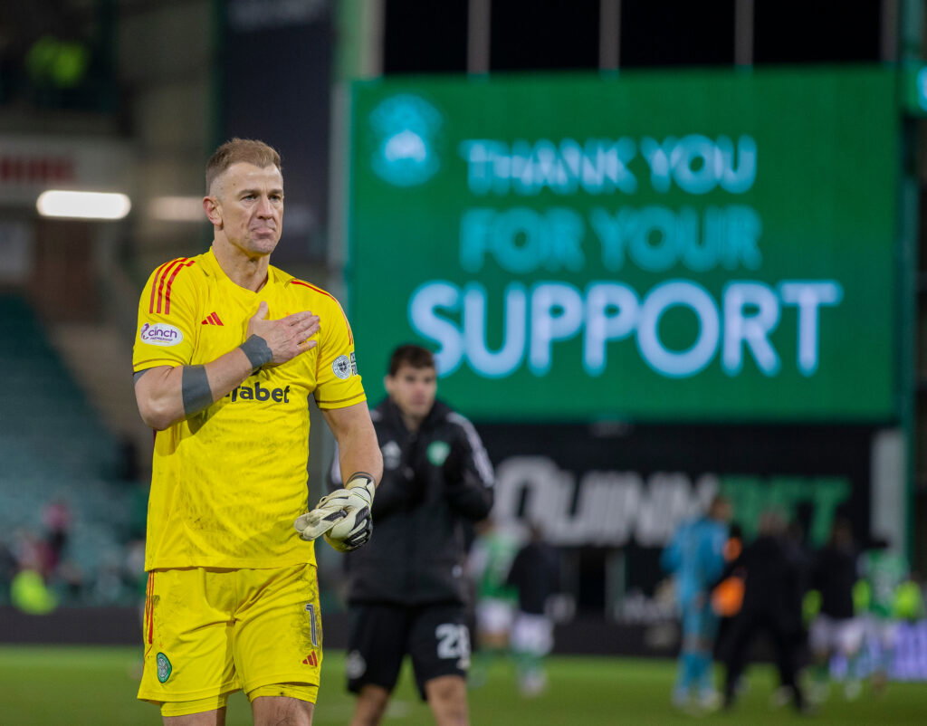 Joe Hart Celtic