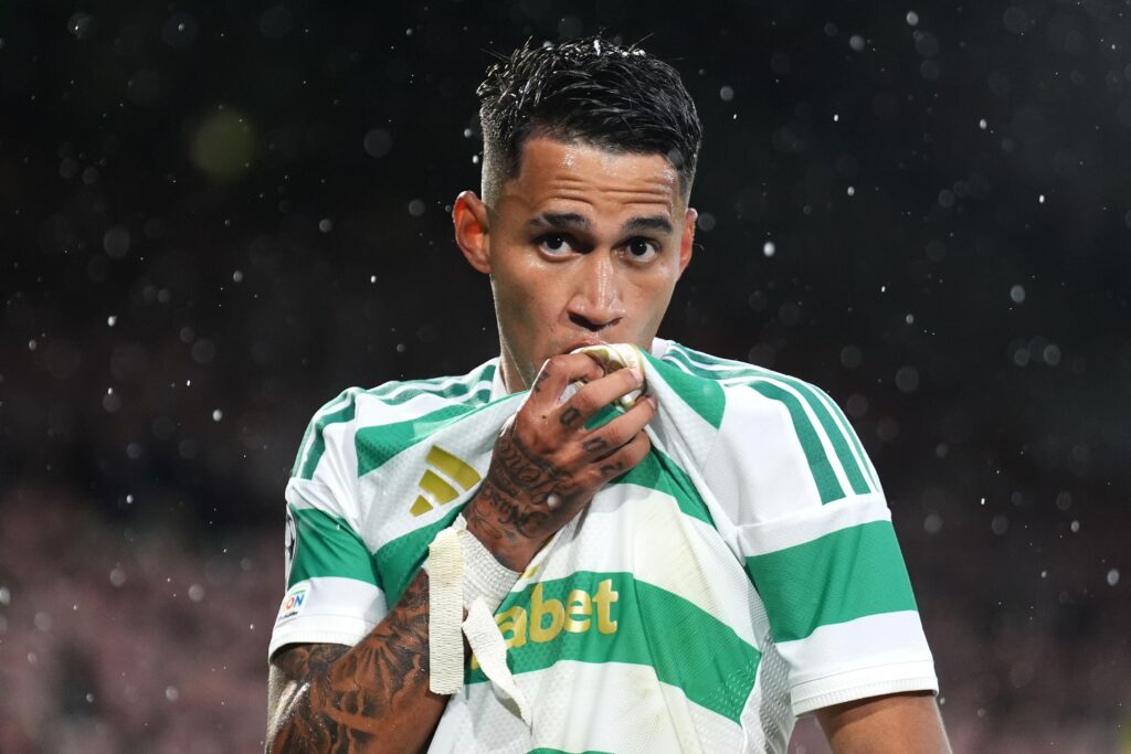 Celtic Duran vs LASK Uefa Champions league